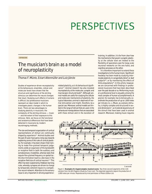 The musician's brain as a model of neuroplasticity
