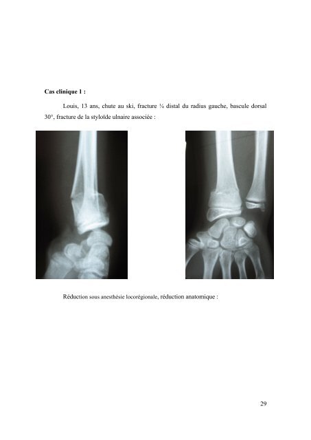 Pierre sylvain Marcheix - desc orthopedie