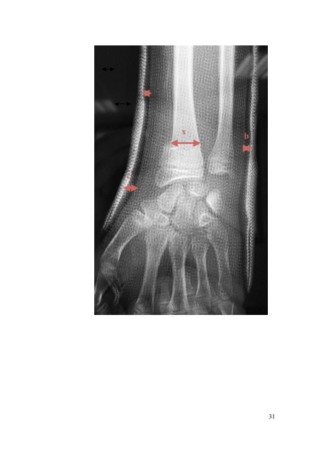 Pierre sylvain Marcheix - desc orthopedie