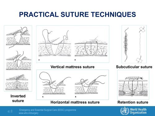 Module 2: Basic Surgical Skills