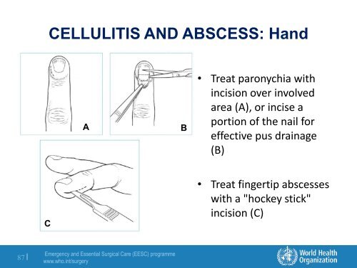 Module 2: Basic Surgical Skills