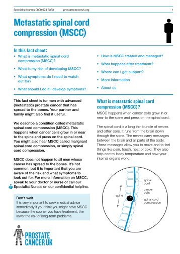 Metastatic spinal cord compression (MSCC) - Prostate Cancer Charity