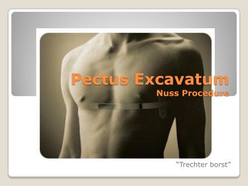 Pectus Excavatum Nuss Procedure - Imelda