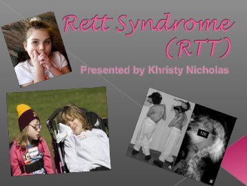 Khristy Nicholas - Rett Syndrome - Stanford University