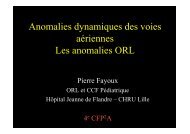 Les anomalies ORL