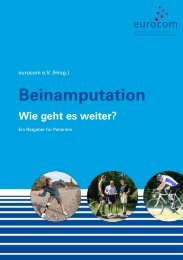 Beinamputation Wie geht es weiter? - beinamputiert-was-geht eV