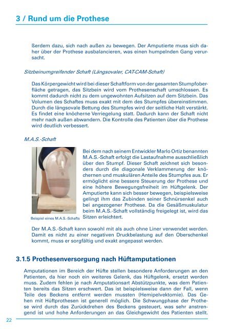 Beinamputation Wie geht es weiter? - beinamputiert-was-geht eV