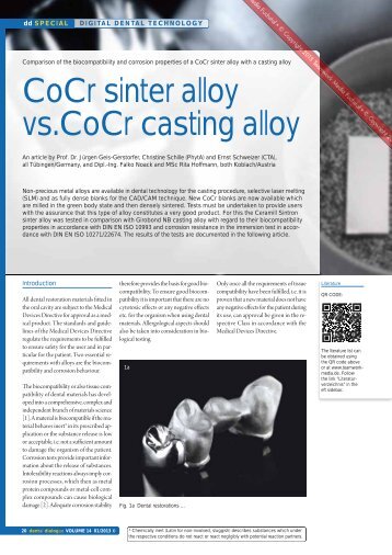 CoCr sinter alloy vs.CoCr casting alloy - AmannGirrbach AG