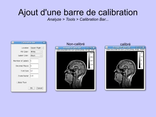 Analyse d'image numérique avec Imagej - Gabriel Lapointe