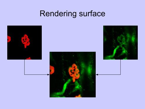 Analyse d'image numérique avec Imagej - Gabriel Lapointe