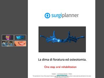 Dime di foratura e osteotomia - Surgiplanner