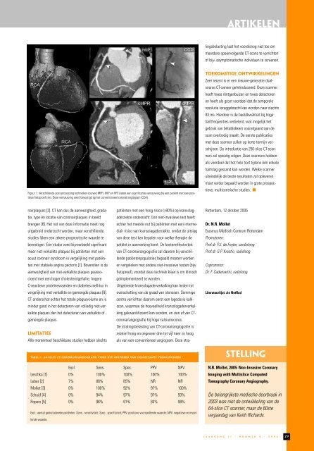 MemoRad 2006-4.pdf - Nederlandse Vereniging voor Radiologie