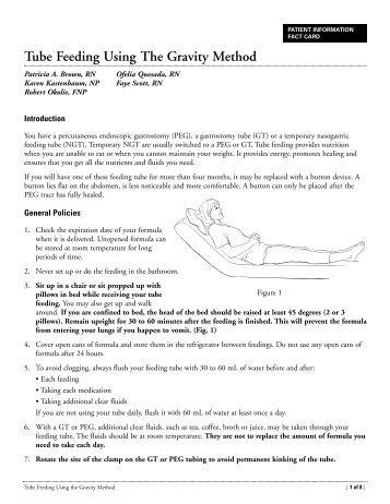 Tube Feeding Using The Gravity Method - Memorial Sloan-Kettering ...