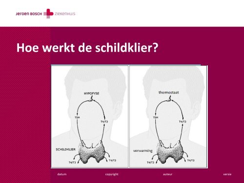 De schildklier, een kleine klier van groot belang - Jeroen Bosch ...