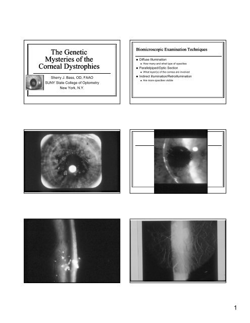 The Genetic Mysteries of the Corneal Dystrophies The Genetic ...