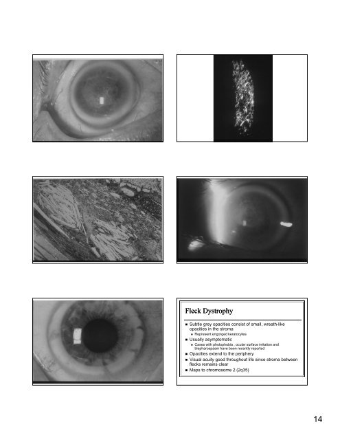 The Genetic Mysteries of the Corneal Dystrophies The Genetic ...