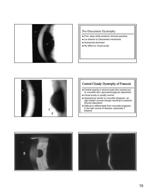 The Genetic Mysteries of the Corneal Dystrophies The Genetic ...