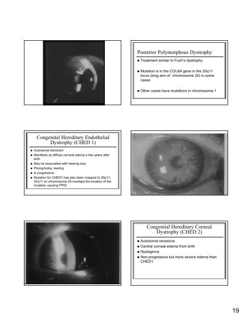 The Genetic Mysteries of the Corneal Dystrophies The Genetic ...