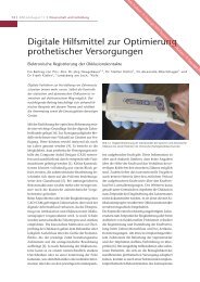 Digitale Hilfsmittel zur Optimierung prothetischer ... - Cumdente