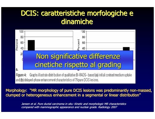 RM della mammella e Neoplasie in situ - Aicod