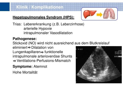 Portale Hypertension - Kinder-Gastroenterologie-Essen