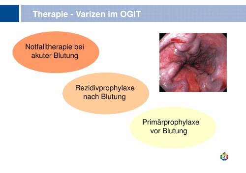 Portale Hypertension - Kinder-Gastroenterologie-Essen