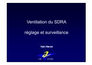 Ventilation du SDRA rÃ©glage et surveillance - SRLF