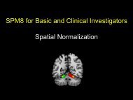 particular brain - Neurometrika