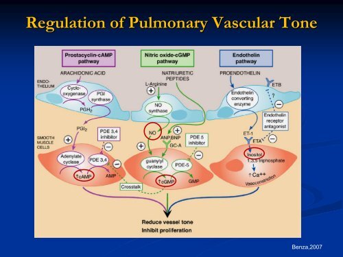 Persistent Pulmonary Hypertension of the Newborn - Mattel ...