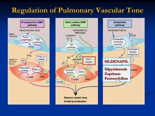 Persistent Pulmonary Hypertension of the Newborn - Mattel ...