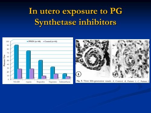 Persistent Pulmonary Hypertension of the Newborn - Mattel ...