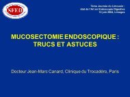 Mucosectomie endoscopique : trucs et astuces - SFED