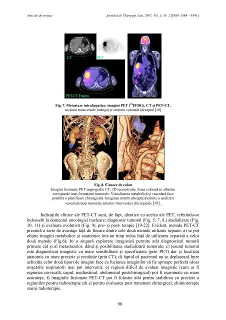 Full text PDF (4.6MB) - Jurnalul de Chirurgie