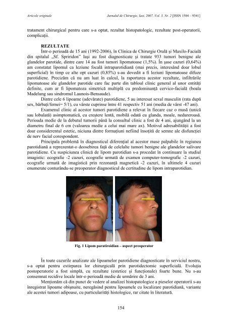 Full text PDF (4.6MB) - Jurnalul de Chirurgie