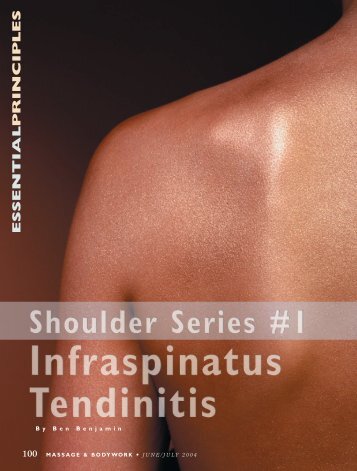 Infraspinatus Tendinitis - Ben Benjamin