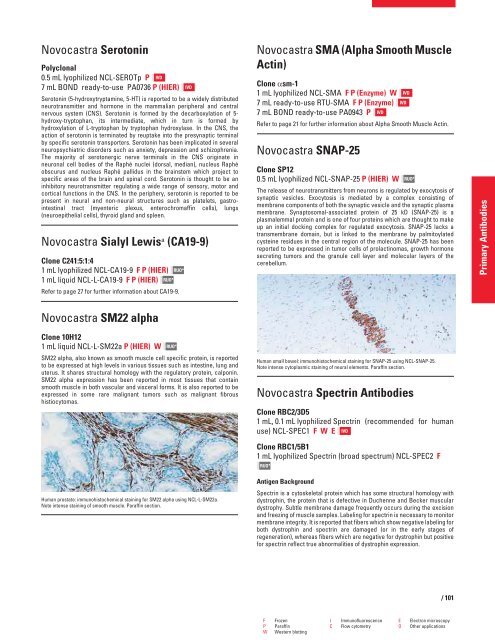 QF0159 Marketing Release Record