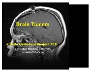 Brain Tumors