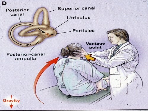 Dizziness in the Elderly-MARTIN SAMUELS.pdf - CCEHS