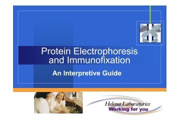 Protein Electrophoresis and Immunofixation
