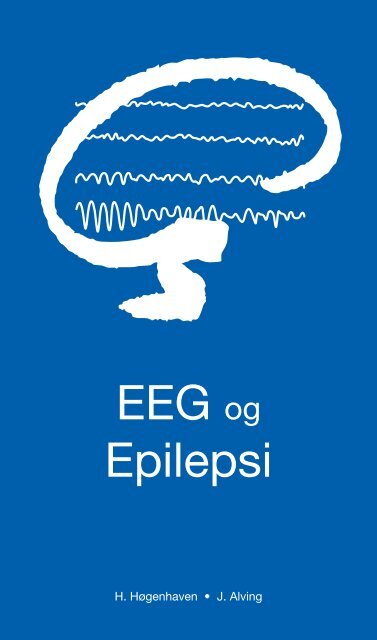 EEG og Epilepsi - Dansk Psykiatrisk Selskab