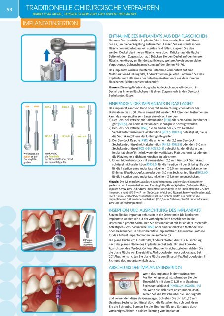 Tapered Screw-VentÃ‚Â® Implantatsystem - Zimmer Dental