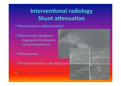 Portosystemic Vascular Anomalies