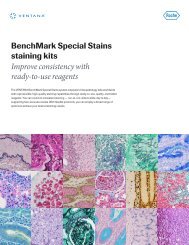 BenchMark Special Stains â staining kits brochure - Ventana ...