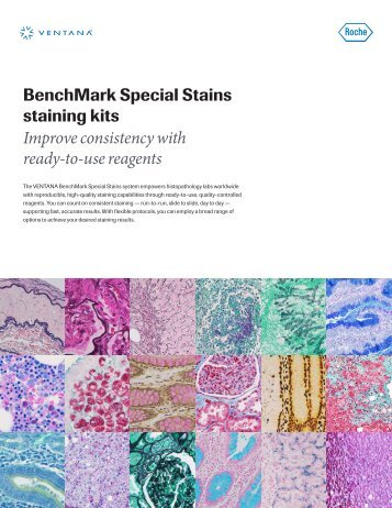 BenchMark Special Stains â staining kits brochure - Ventana ...