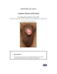 Interesting Case Series Acquired Absence of the Penis - ePlasty