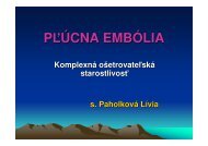 PÄ¾Ãºcna embÃ³lia