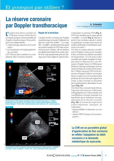 échoguidé - Consensus Online