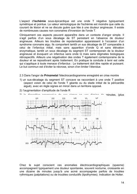 1 ELECTROCARDIOGRAPHIE J Valty, A Cohen  2006 Plus de 100 ...