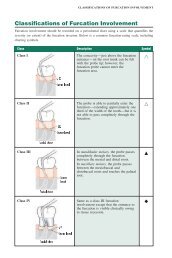 Classifications of Furcation Involvement