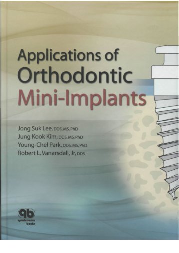 Applications_of_Orthodontic_Mini-Implants